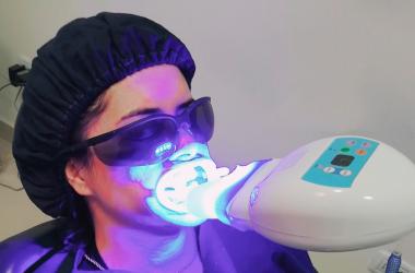 Blanqueamiento Dental con Laser